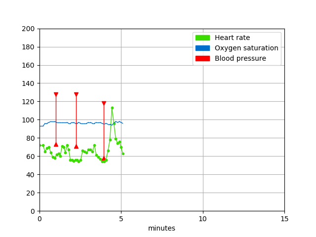 Beispiel-Plot Vitalparameter